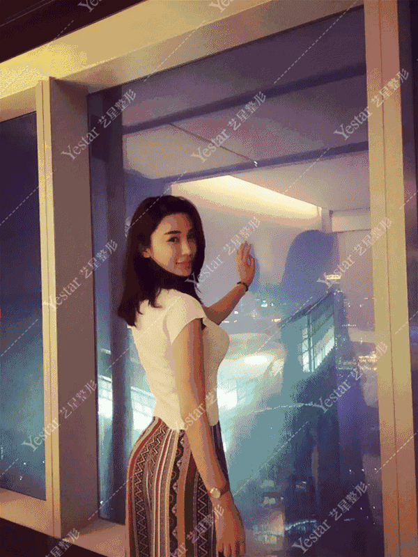 大连艺星整形宫廷动感隆胸有个胸大的女朋友,是什么体验?