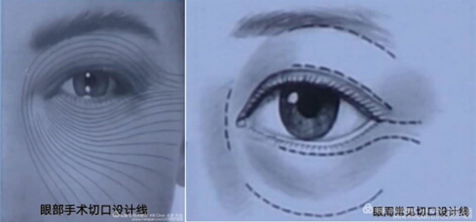 1861年由澳大利亚解剖学家karl 1212langer提出.