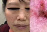 女子陪闺蜜看病，结果自己查出癌症